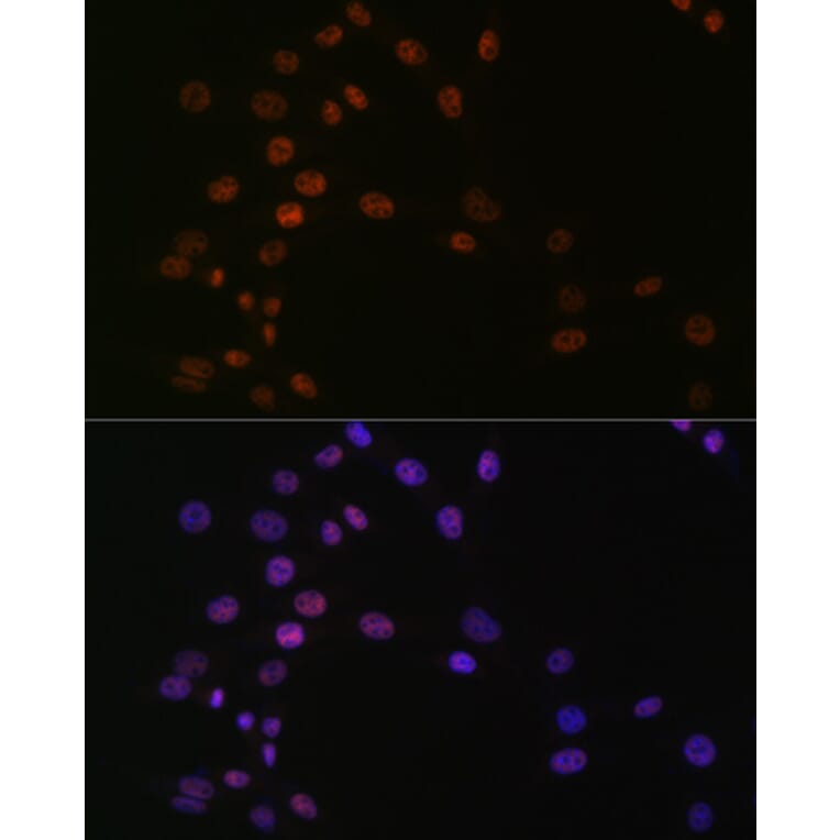 Immunofluorescence - Anti-ASH2L Antibody [ARC0326] (A305306) - Antibodies.com