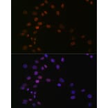 Immunofluorescence - Anti-ASH2L Antibody [ARC0326] (A305306) - Antibodies.com