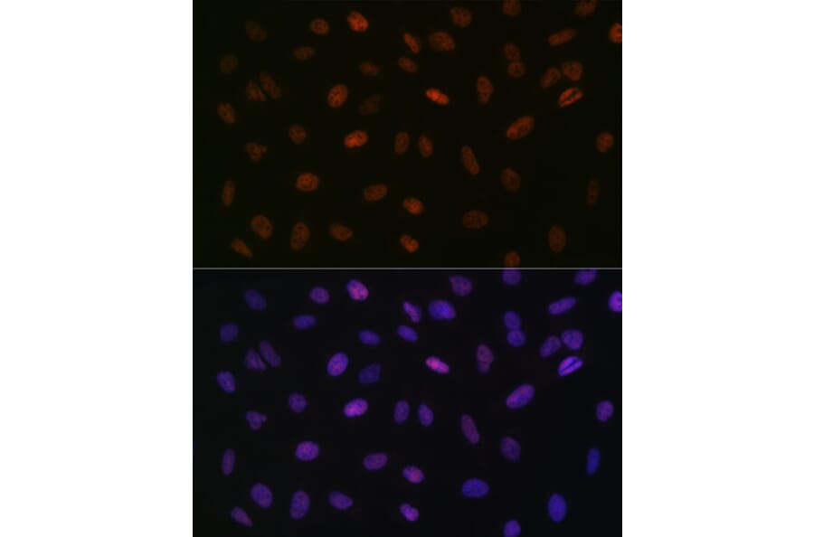 Immunofluorescence - Anti-ASH2L Antibody [ARC0326] (A305306) - Antibodies.com