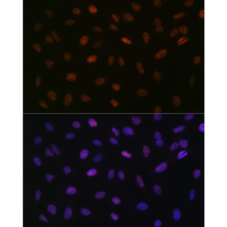 Immunofluorescence - Anti-ASH2L Antibody [ARC0326] (A305306) - Antibodies.com