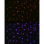 Immunofluorescence - Anti-ASH2L Antibody [ARC0326] (A305306) - Antibodies.com