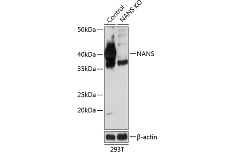 Western Blot - Anti-NANS Antibody (A305309) - Antibodies.com