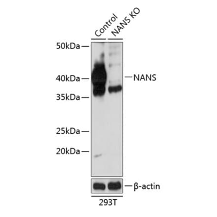 Western Blot - Anti-NANS Antibody (A305309) - Antibodies.com