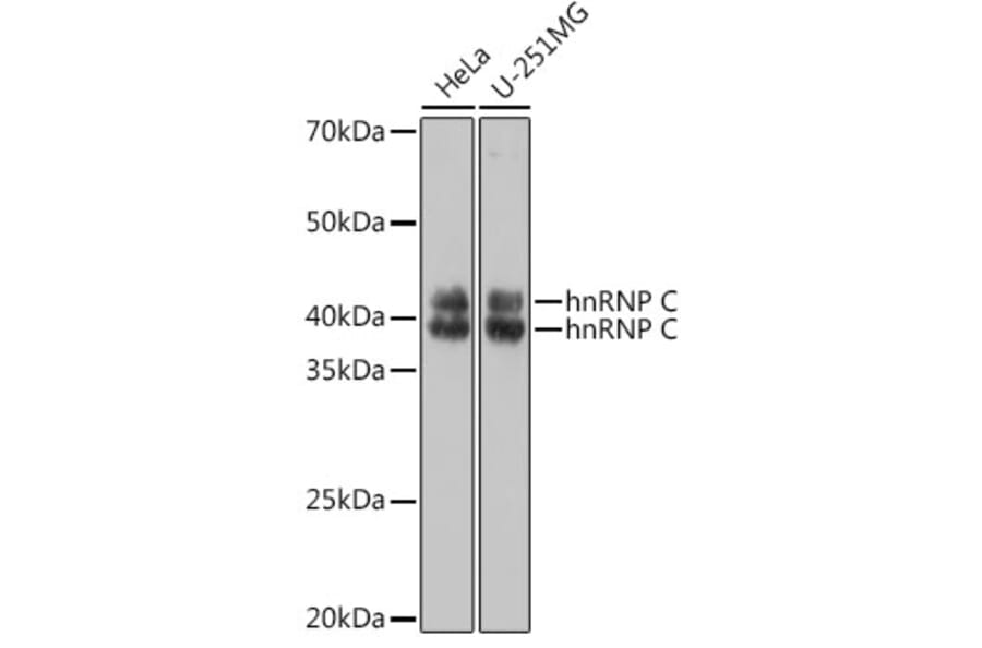 Western Blot - Anti-hnRNP C1/C2/HNRNPC Antibody (A305310) - Antibodies.com