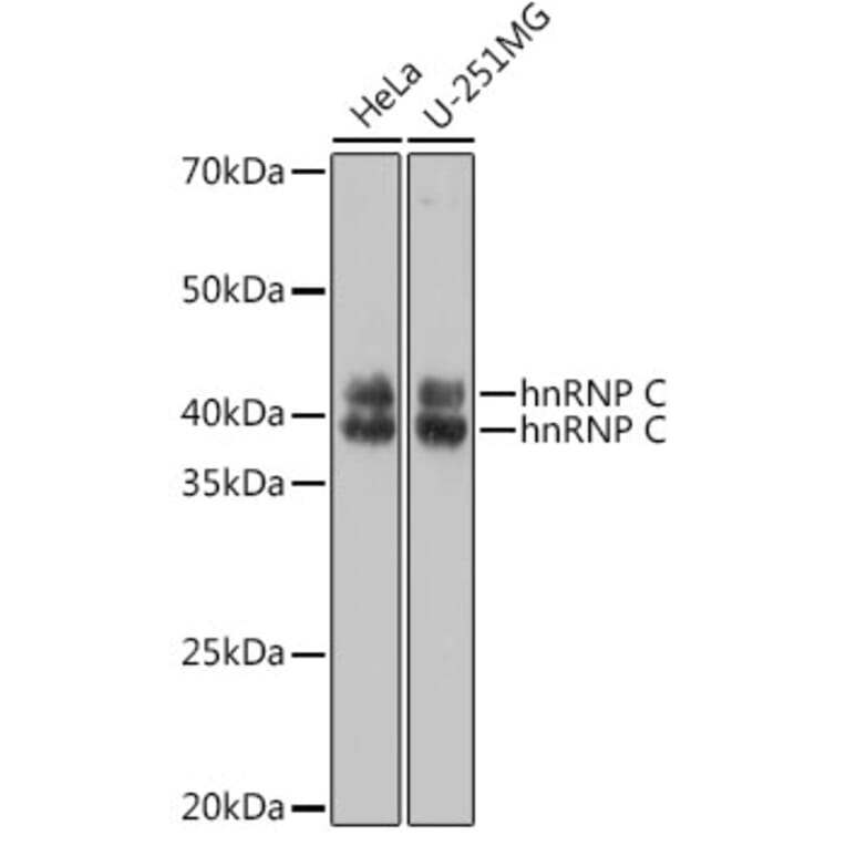Western Blot - Anti-hnRNP C1/C2/HNRNPC Antibody (A305310) - Antibodies.com