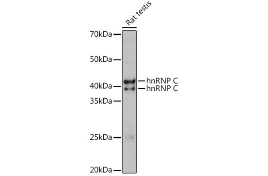 Western Blot - Anti-hnRNP C1/C2/HNRNPC Antibody (A305310) - Antibodies.com