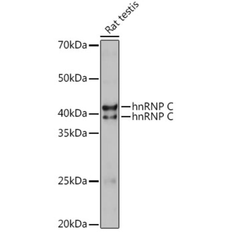 Western Blot - Anti-hnRNP C1/C2/HNRNPC Antibody (A305310) - Antibodies.com