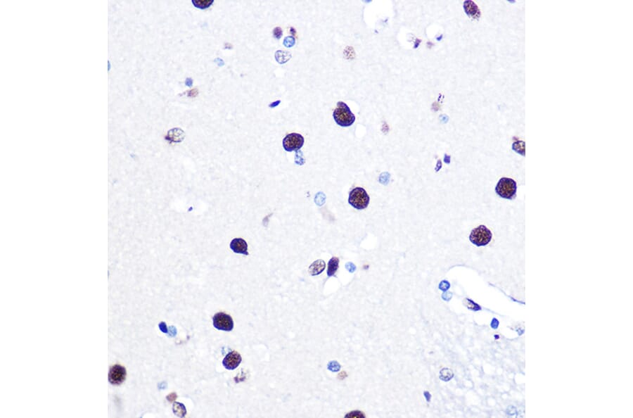 Immunohistochemistry - Anti-hnRNP C1/C2/HNRNPC Antibody (A305310) - Antibodies.com