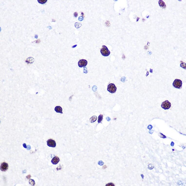 Immunohistochemistry - Anti-hnRNP C1/C2/HNRNPC Antibody (A305310) - Antibodies.com