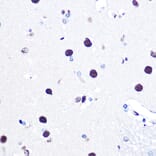 Immunohistochemistry - Anti-hnRNP C1/C2/HNRNPC Antibody (A305310) - Antibodies.com