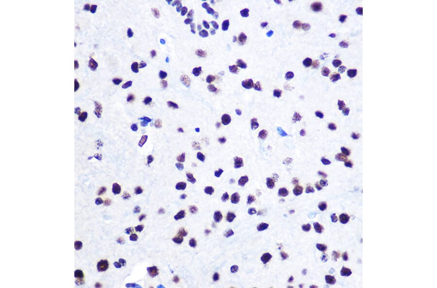 Immunohistochemistry - Anti-hnRNP C1/C2/HNRNPC Antibody (A305310) - Antibodies.com
