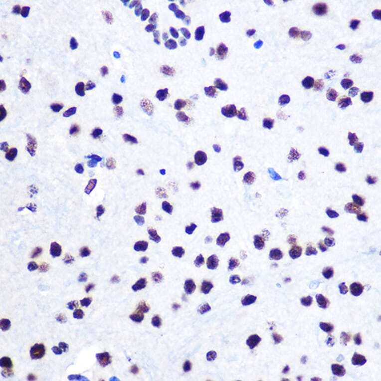 Immunohistochemistry - Anti-hnRNP C1/C2/HNRNPC Antibody (A305310) - Antibodies.com