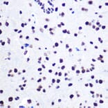 Immunohistochemistry - Anti-hnRNP C1/C2/HNRNPC Antibody (A305310) - Antibodies.com