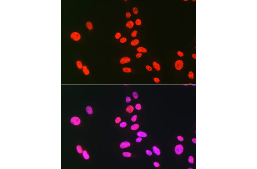 Immunofluorescence - Anti-hnRNP C1/C2/HNRNPC Antibody (A305310) - Antibodies.com