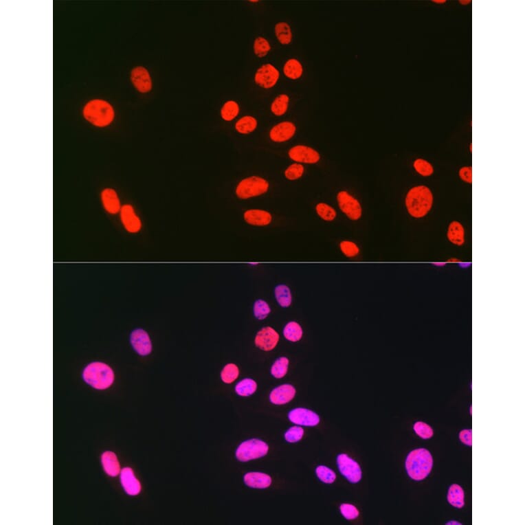 Immunofluorescence - Anti-hnRNP C1/C2/HNRNPC Antibody (A305310) - Antibodies.com