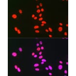 Immunofluorescence - Anti-hnRNP C1/C2/HNRNPC Antibody (A305310) - Antibodies.com