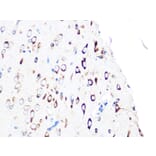 Immunohistochemistry - Anti-PUMA Antibody [ARC0247] (A305311) - Antibodies.com