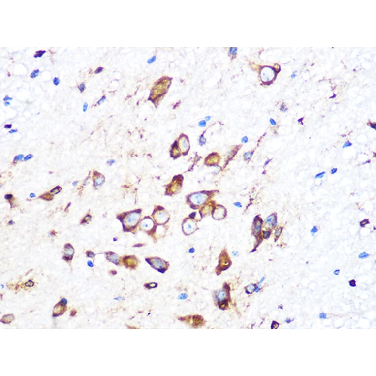 Immunohistochemistry - Anti-PUMA Antibody [ARC0247] (A305311) - Antibodies.com