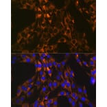 Immunofluorescence - Anti-PUMA Antibody [ARC0247] (A305311) - Antibodies.com