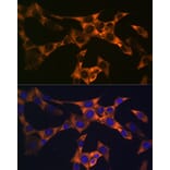 Immunofluorescence - Anti-PUMA Antibody [ARC0247] (A305311) - Antibodies.com