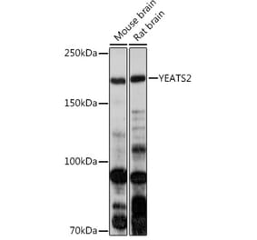 Western Blot - Anti-YEATS2 Antibody (A305312) - Antibodies.com