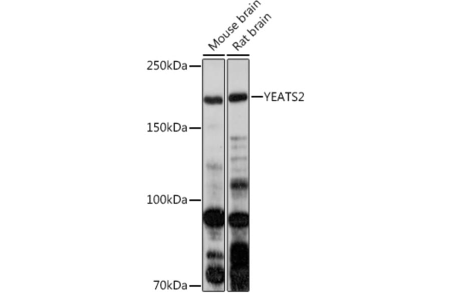 Western Blot - Anti-YEATS2 Antibody (A305312) - Antibodies.com