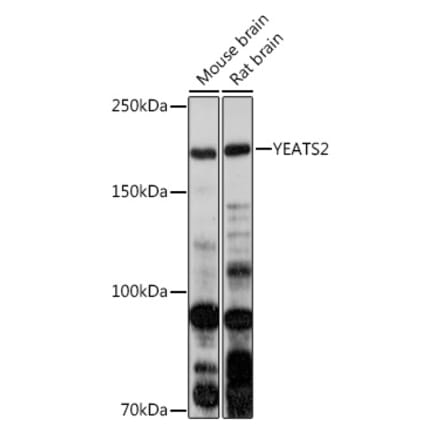 Western Blot - Anti-YEATS2 Antibody (A305312) - Antibodies.com