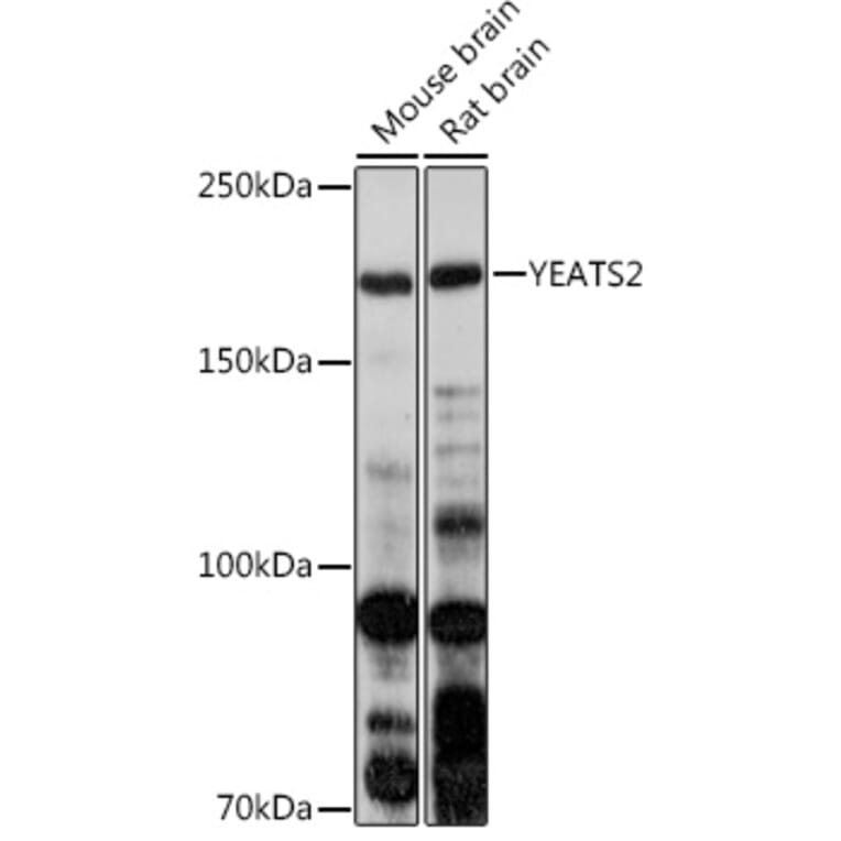 Western Blot - Anti-YEATS2 Antibody (A305312) - Antibodies.com