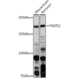 Western Blot - Anti-YEATS2 Antibody (A305312) - Antibodies.com