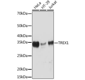 Western Blot - Anti-TREX1 Antibody [ARC0841] (A305313) - Antibodies.com