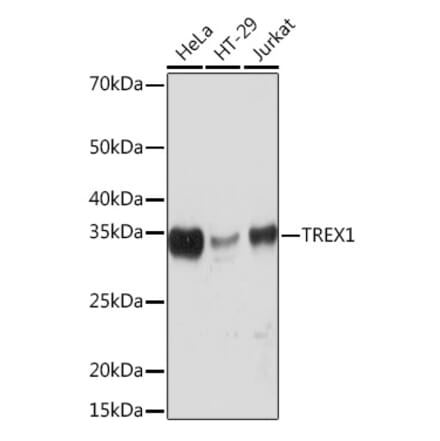 Western Blot - Anti-TREX1 Antibody [ARC0841] (A305313) - Antibodies.com