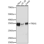 Western Blot - Anti-TREX1 Antibody [ARC0841] (A305313) - Antibodies.com