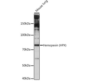 Western Blot - Anti-Hemopexin Antibody [ARC1444] (A305314) - Antibodies.com