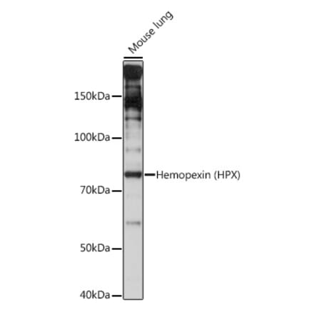 Western Blot - Anti-Hemopexin Antibody [ARC1444] (A305314) - Antibodies.com