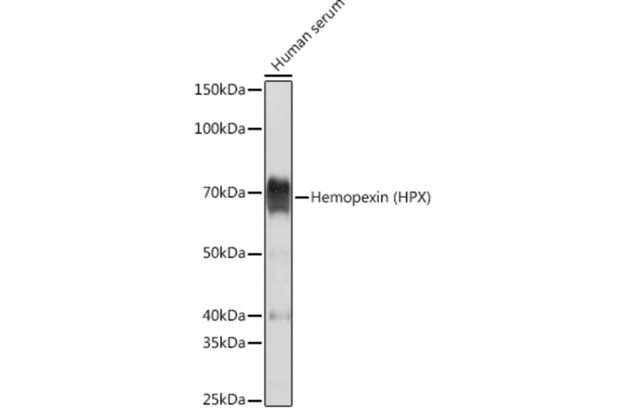 Western Blot - Anti-Hemopexin Antibody [ARC1444] (A305314) - Antibodies.com