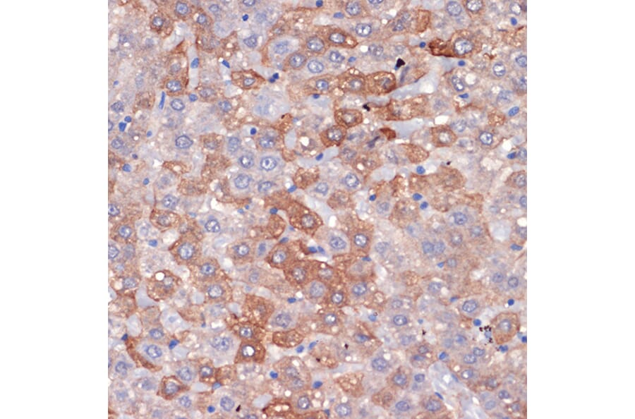 Immunohistochemistry - Anti-Hemopexin Antibody [ARC1444] (A305314) - Antibodies.com