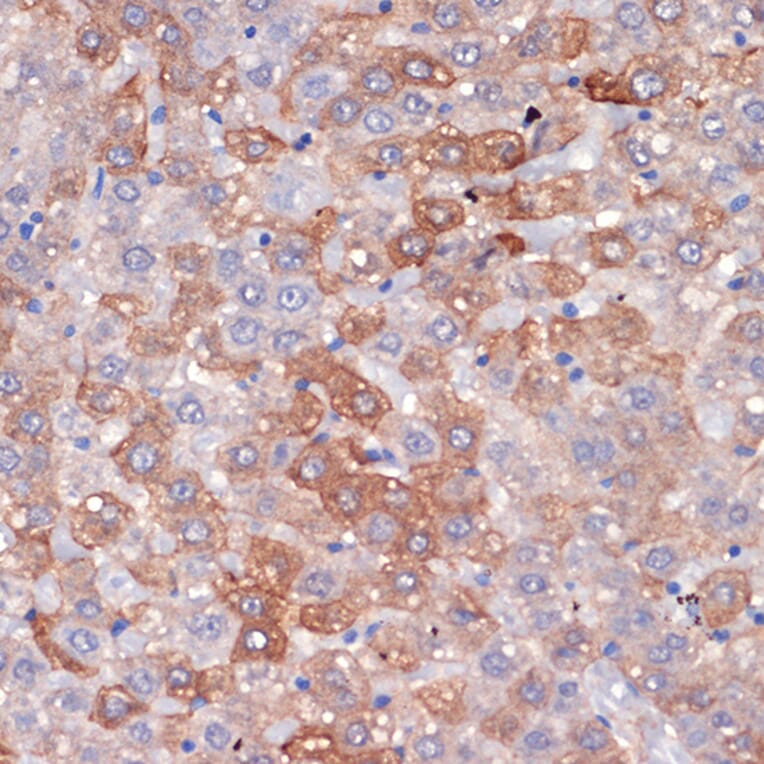 Immunohistochemistry - Anti-Hemopexin Antibody [ARC1444] (A305314) - Antibodies.com