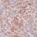 Immunohistochemistry - Anti-Hemopexin Antibody [ARC1444] (A305314) - Antibodies.com