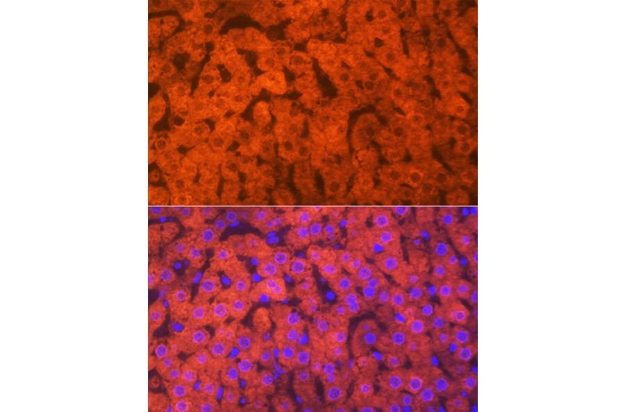 Immunofluorescence - Anti-Hemopexin Antibody [ARC1444] (A305314) - Antibodies.com