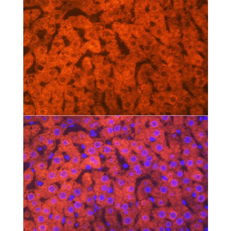 Immunofluorescence - Anti-Hemopexin Antibody [ARC1444] (A305314) - Antibodies.com