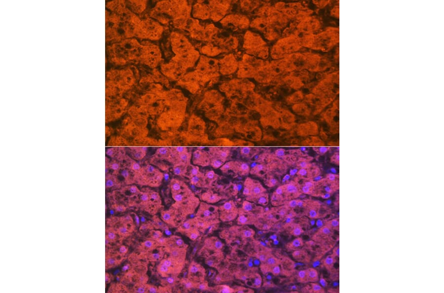 Immunofluorescence - Anti-Hemopexin Antibody [ARC1444] (A305314) - Antibodies.com