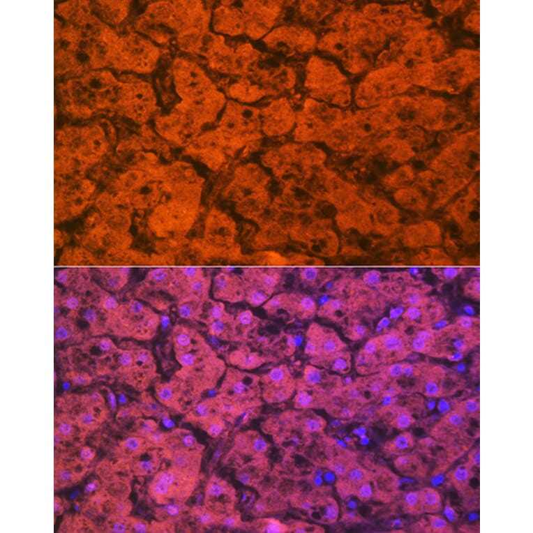 Immunofluorescence - Anti-Hemopexin Antibody [ARC1444] (A305314) - Antibodies.com
