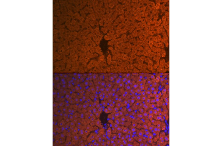 Immunofluorescence - Anti-Hemopexin Antibody [ARC1444] (A305314) - Antibodies.com