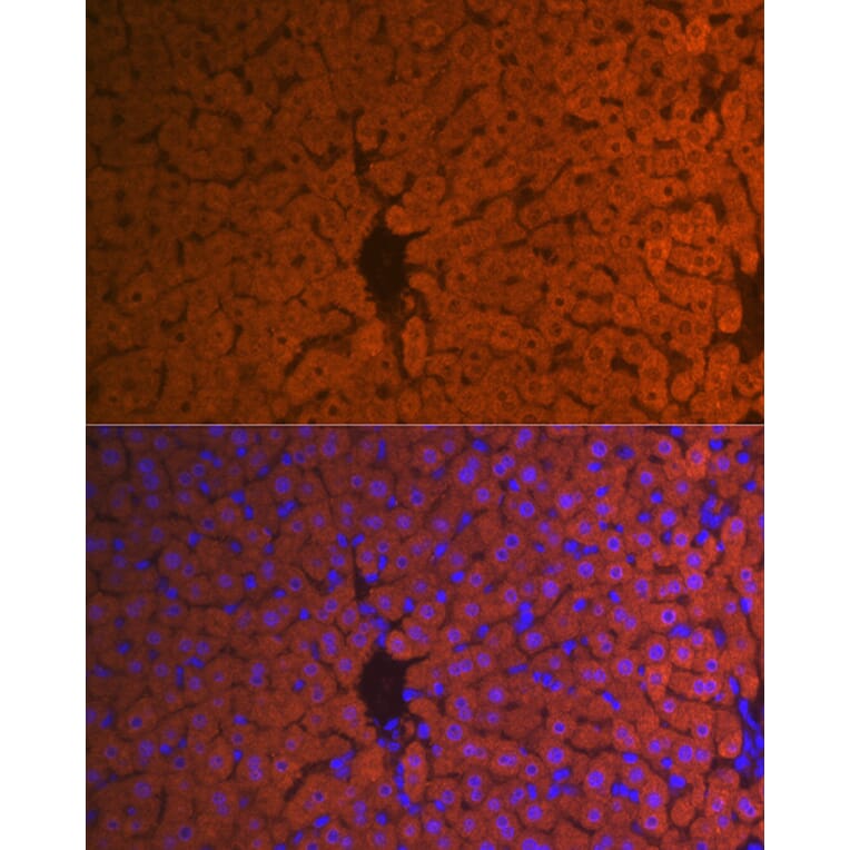 Immunofluorescence - Anti-Hemopexin Antibody [ARC1444] (A305314) - Antibodies.com