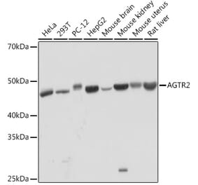 Western Blot - Anti-Angiotensin II Type 2 Receptor Antibody [ARC2064] (A305315) - Antibodies.com