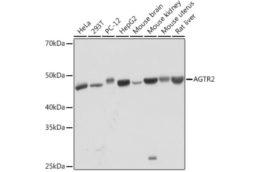 Western Blot - Anti-Angiotensin II Type 2 Receptor Antibody [ARC2064] (A305315) - Antibodies.com