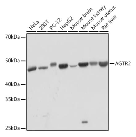 Western Blot - Anti-Angiotensin II Type 2 Receptor Antibody [ARC2064] (A305315) - Antibodies.com