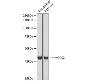 Western Blot - Anti-HMGCS2 Antibody [ARC2390] (A305318) - Antibodies.com