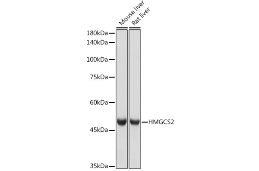Western Blot - Anti-HMGCS2 Antibody [ARC2390] (A305318) - Antibodies.com