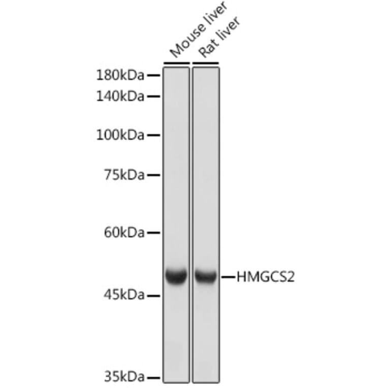 Western Blot - Anti-HMGCS2 Antibody [ARC2390] (A305318) - Antibodies.com